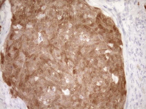 p16INK4a / CDKN2A Antibody (clone OTI5G9)