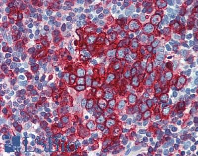 IHC-plus™ Monoclonal Mouse anti-Human HLA-DP/DR Antibody (clone HL-38, IHC, WB)