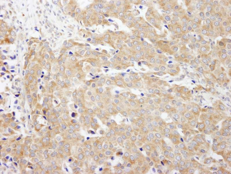 CAD Antibody (aa1650-1700)