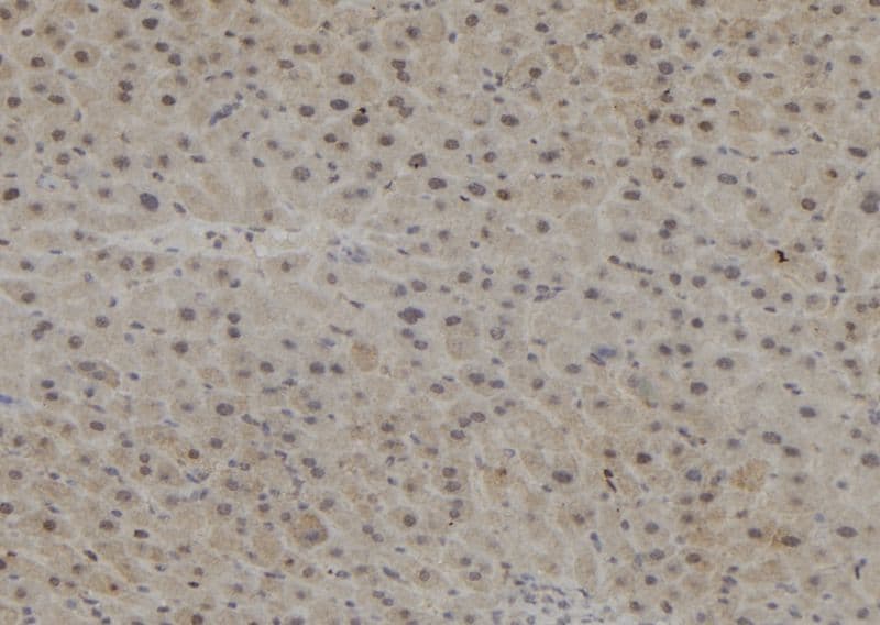 Polyclonal Rabbit anti-Human PPP1R15B Antibody (IHC, WB)