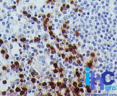 Monoclonal Mouse anti-Human RUNX3 Antibody (clone 2B10E8, aa126-310, IHC, WB)