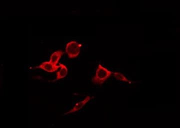 SDC1 / Syndecan 1 / CD138 Antibody