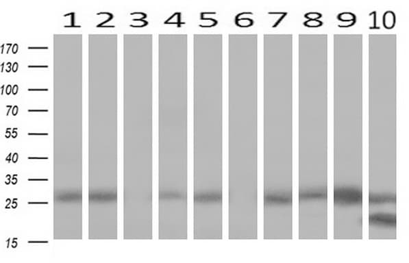 Monoclonal Mouse anti-Human LGALS3 / Galectin 3 Antibody (clone UMAB157, IHC, IF, WB)