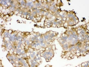 APOA1 / Apolipoprotein A 1 Antibody
