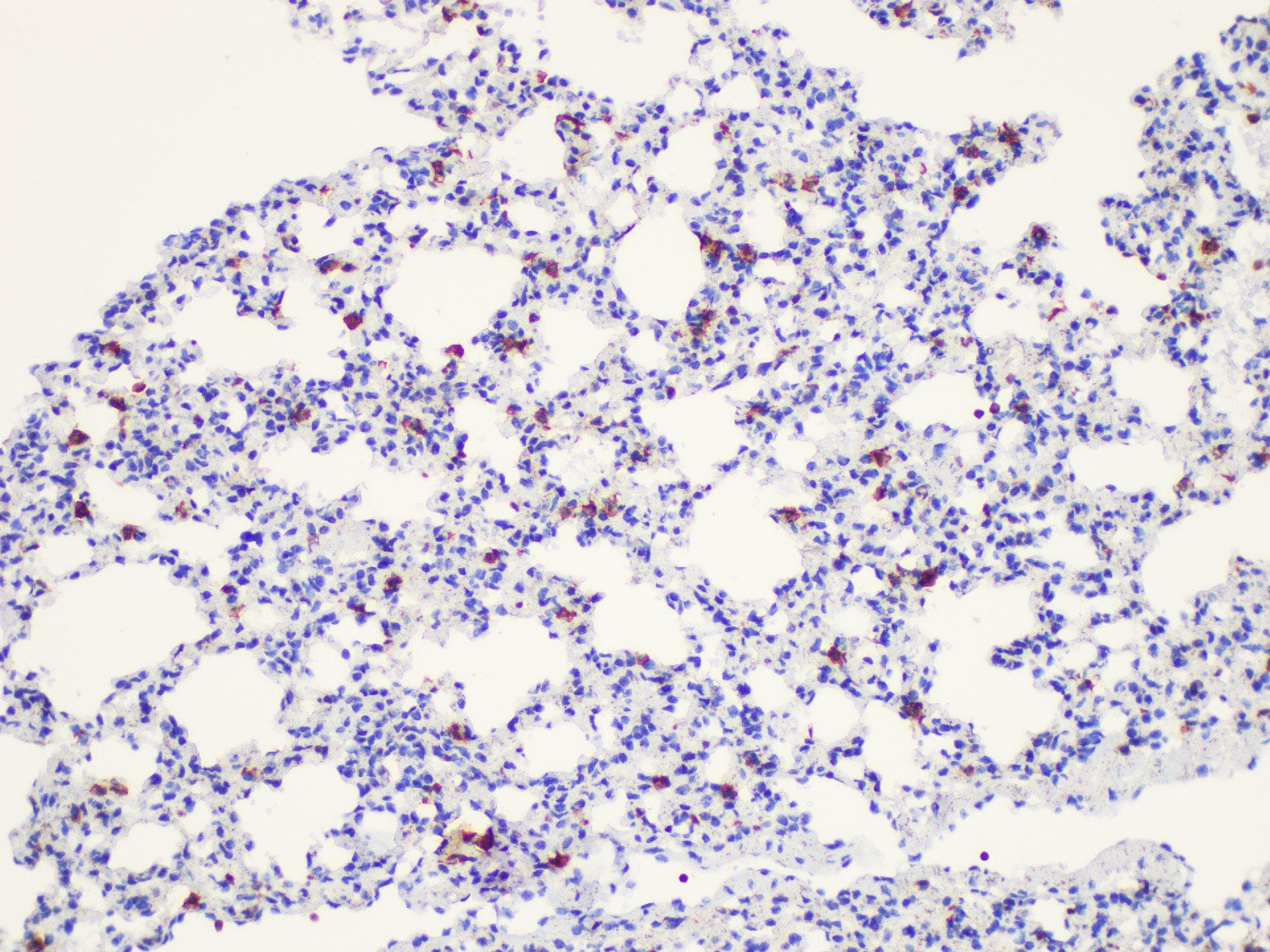 LGALS3 / Galectin 3 Antibody