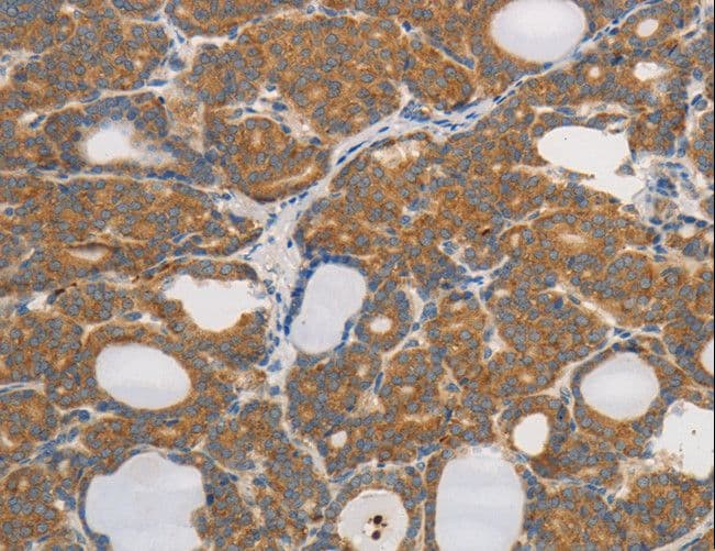 Polyclonal Rabbit anti-Human PP2CB / PPP2CB Antibody (IHC)