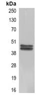CA9 / Carbonic Anhydrase IX Antibody