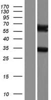 ARHGAP9 Protein (Over-Expression Lysate Myc-DDK (Flag))