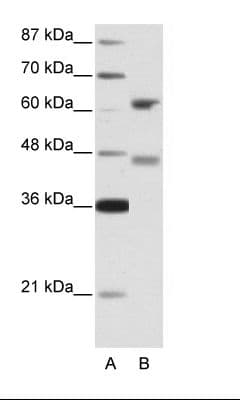 Polyclonal Rabbit anti-Human RFX4 Antibody (aa352-401, WB)
