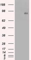 CTNNB1 / Beta Catenin Antibody (clone OTI3G4)
