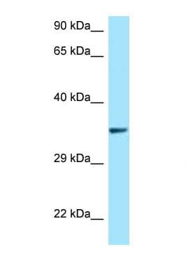 QKI Antibody (aa52-101)