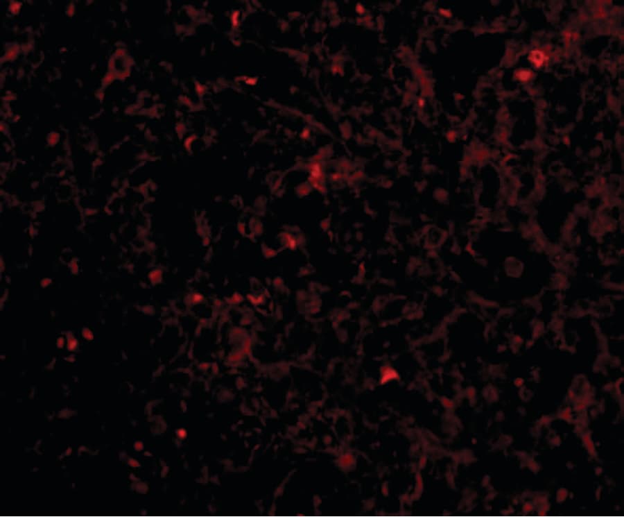 IHC-plus™ STEAP1 / STEAP Antibody (aa130-180)