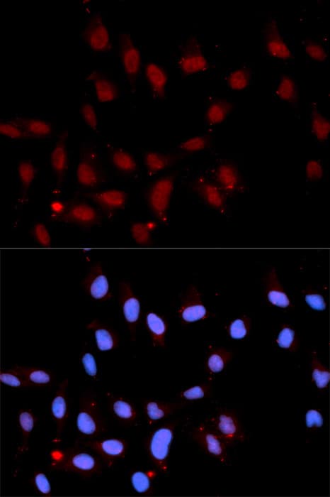 STAT3 Antibody (phospho-Tyr705)