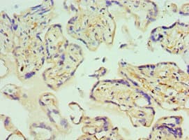 GLRX2 / Glutaredoxin 2 Antibody (aa1-124)