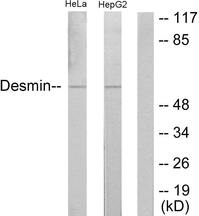 DES / Desmin Antibody (p60)