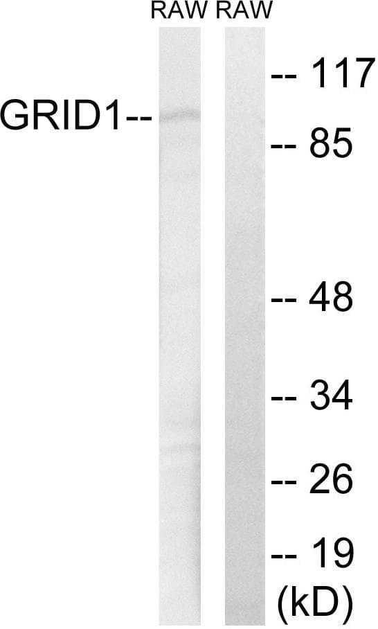 Polyclonal Rabbit anti-Human GRID1 Antibody (IHC, WB)