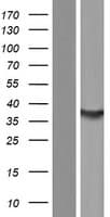 Human SULT1C4 / Sulfotransferase 1C4 Protein (Over-Expression Lysate Myc-DDK (Flag))