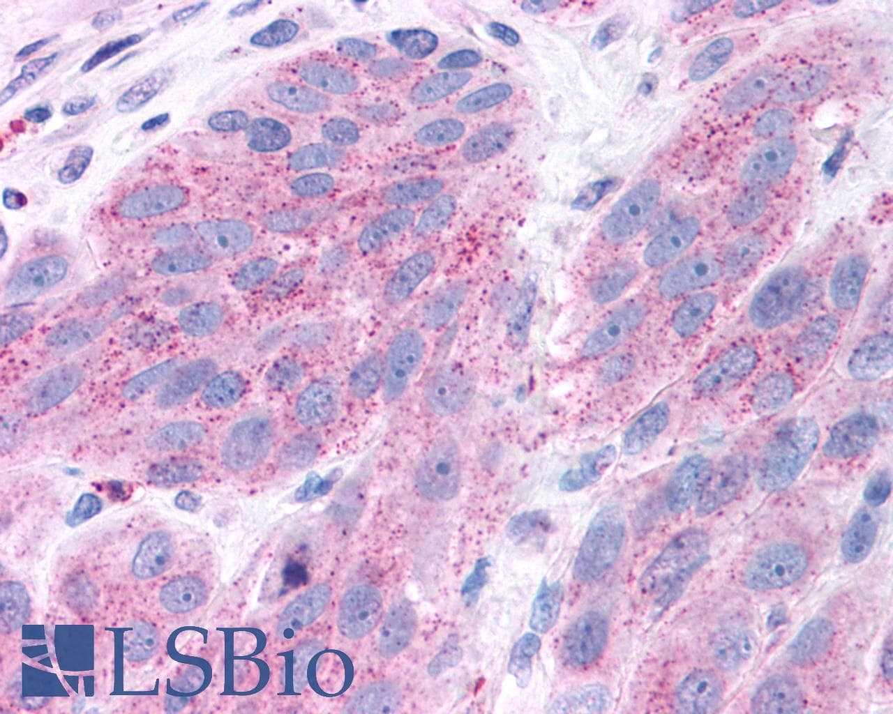 PathPlus™ NPY5R Antibody (Cytoplasmic Domain)