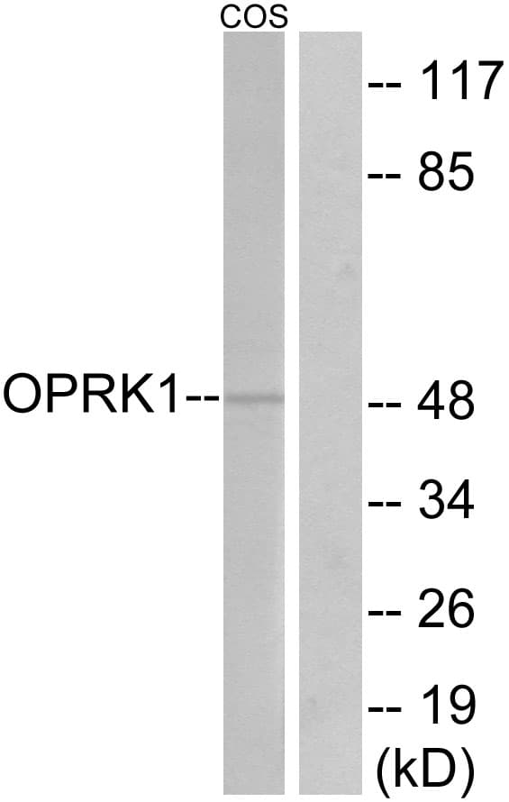 OPRK1 / Kappa Opioid Receptor Antibody (aa321-370)