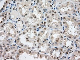 ERIC-1 / TACC3 Antibody (clone OTI8F6, Carrier-free)