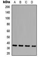 GLB1L3 Antibody (Internal)