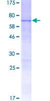 Human RNF215 Protein (Recombinant GST)