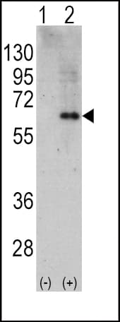 PRKAA2 / AMPK Alpha 2 Antibody (aa453-483)