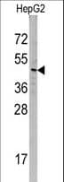 SNX6 Antibody (aa81-110)