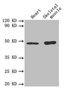 IHC-plus™ Polyclonal Rabbit anti-Human TGFB2 / TGF Beta2 Antibody (aa304-413, IHC, WB)