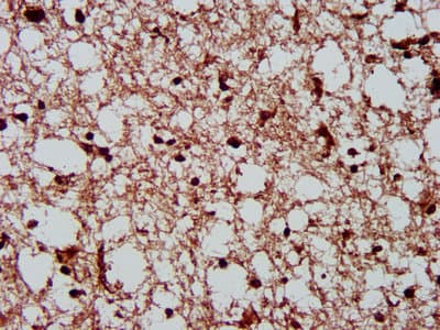Polyclonal Rabbit anti-Human CSNK2A1 Antibody (aa1-391)