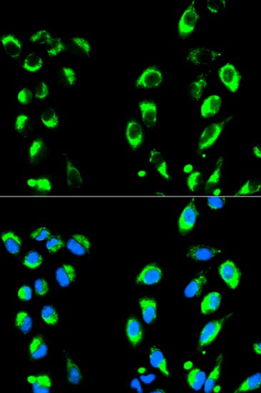 Polyclonal Rabbit anti-Human NFKBIA / IKB Alpha / IKBA Antibody (IHC, IF, WB)