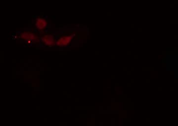 PPP4R2 Antibody