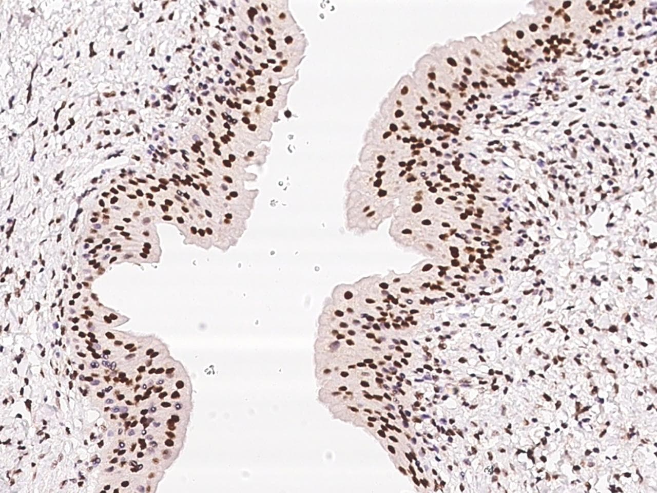 Polyclonal Rabbit anti-Human ZNF512B Antibody (IHC)
