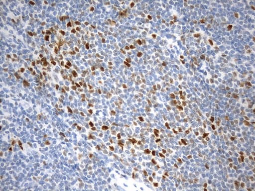 EZH2 Antibody (aa182-431, clone UMAB264)