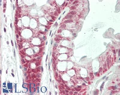 IHC-plus™ SMPD1 / Acid Sphingomyelinase Antibody