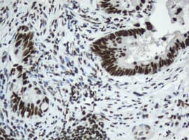 SF3A1 / SF3A120 Antibody (aa249-568, clone OTI2C4, Carrier-free)