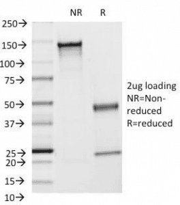 ICAM-1 / CD54 Antibody (clone F4-31C2)