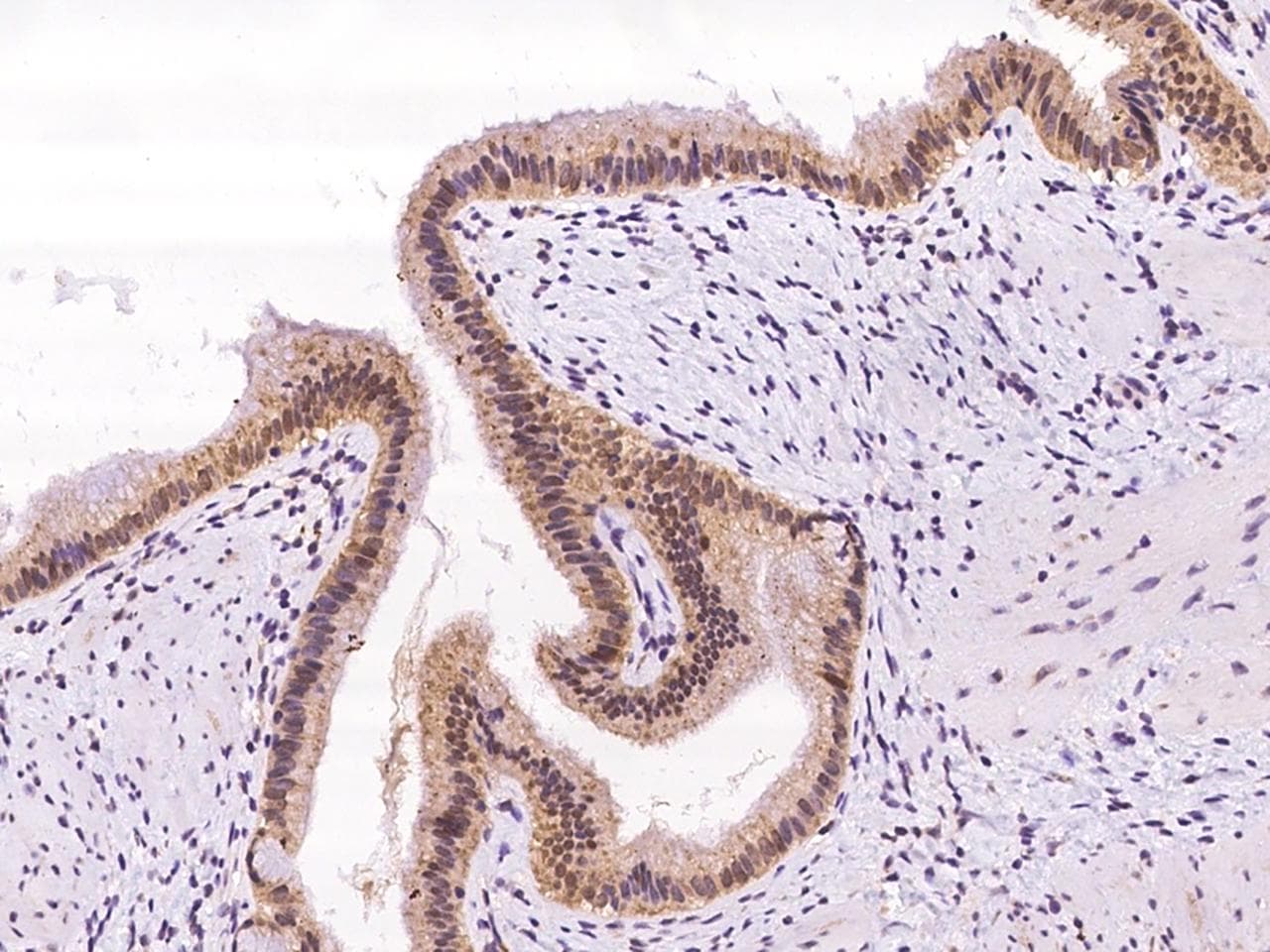 Polyclonal Rabbit anti-Human NT5C3B / NT5C3L Antibody (IHC)