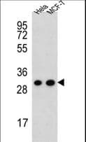 Polyclonal Rabbit anti-Human CYC1 / Cytochrome C-1 Antibody (aa259-287, IHC, WB)
