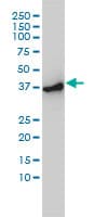 Monoclonal Mouse anti-Human ACTR2 / ARP2 Antibody (clone 1B10-C4, IHC, WB)