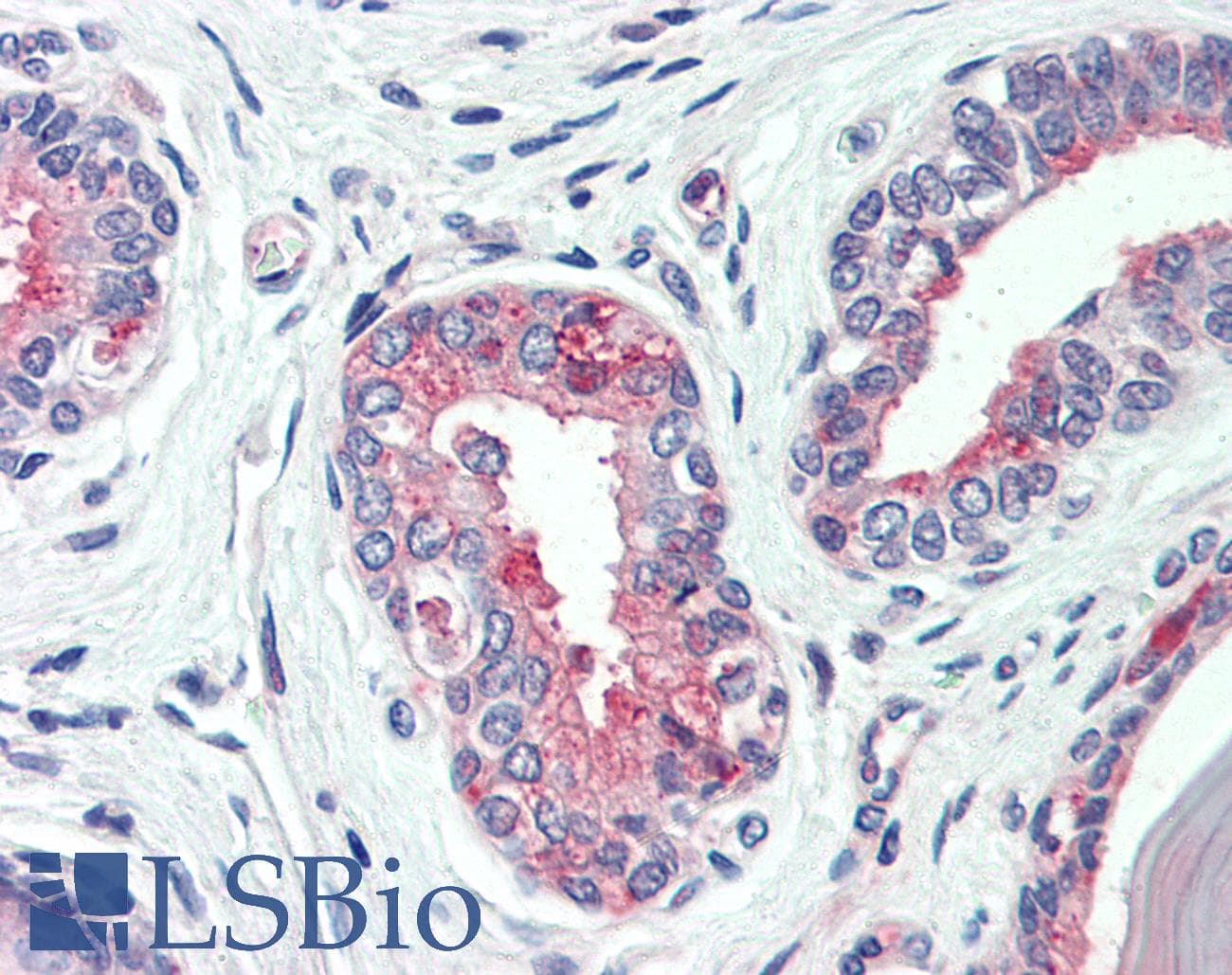 IHC-plus™ SLC12A2 / NKCC1 Antibody (C-Terminus)
