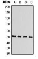 ARRB1 / Beta Arrestin 1 Antibody (C-Terminus)