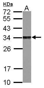 PSME3 Antibody (aa1-254)