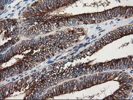 TUBB4 / Tubulin Beta 4 Antibody (clone 3C12, Carrier-free)