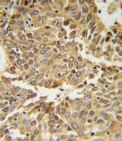 Polyclonal Rabbit anti-Human HIF1A / HIF1 Alpha Antibody (aa1-30, IHC, IF, WB)