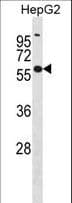 Polyclonal Rabbit anti-Human GLUD2 Antibody (aa75-103, WB)