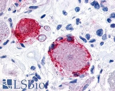 PathPlus™ Polyclonal Rabbit anti-Human MRGPRX3 / MRGX3 Antibody (Extracellular Domain, IHC)