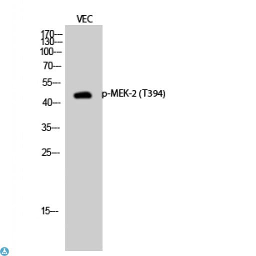 MAP2K2 / MKK2 / MEK2 Antibody