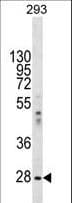 Polyclonal Rabbit anti-Human EIF2B1 Antibody (aa136-163, IHC, WB)