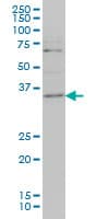 Monoclonal Mouse anti-Human ZIC4 Antibody (clone 3D5, IF, WB)